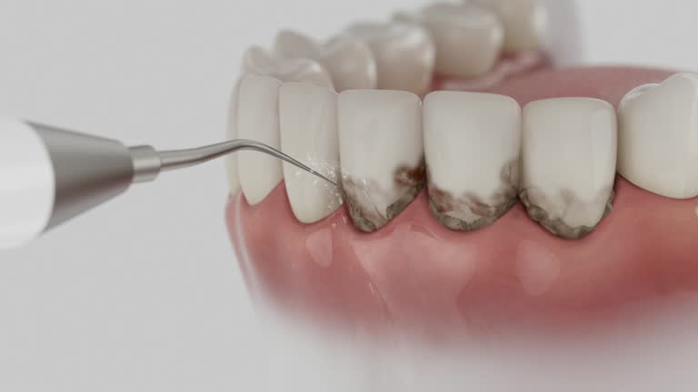 Trusted Dental Implants service in Vista Center, NJ - Dentist Open Now